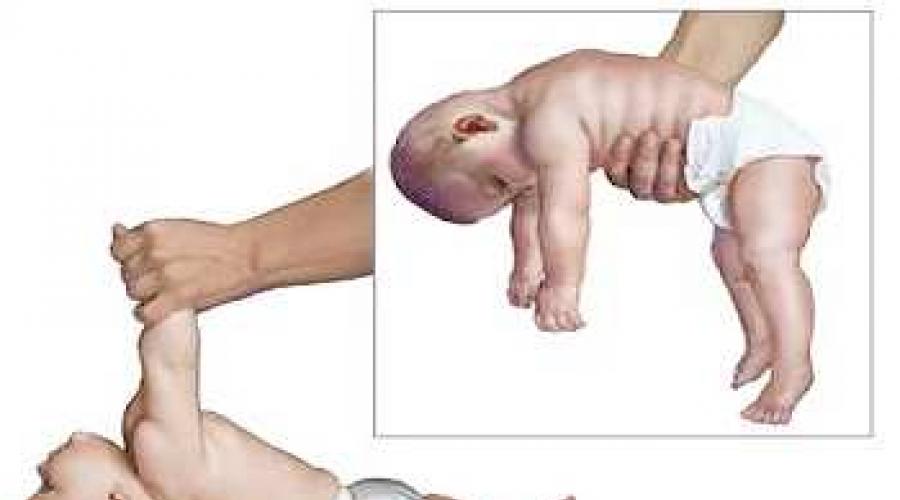 Почему новорожденного трясет. Слабый тонус мышц у малыша 4 месяца. ДЦП тонус мышц у ребенка. Мышечная дистония нижних конечностей. Мышечная гипотония конечностей.