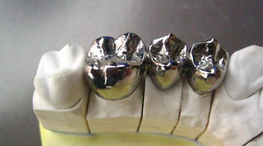Лучший материал для коронок. Какие коронки на зубы лучше подойдут в разных случаях? Лучшие зубные коронки