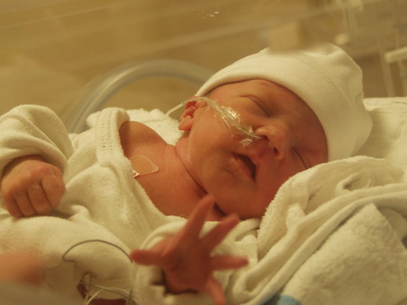 What is newborn asphyxia: pulmonary and extrapulmonary causes of development, medical tactics